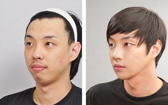Foto operasi plastik korea 4