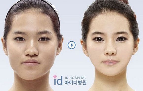 Foto operasi plastik korea 5